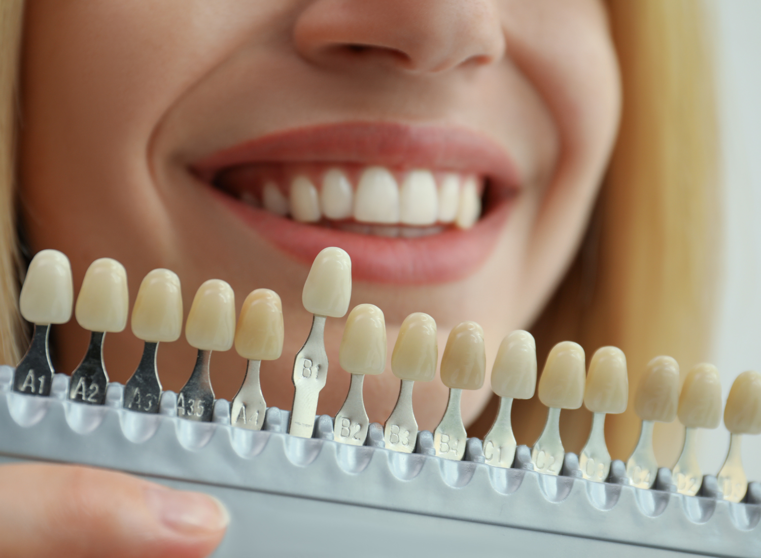 5 Common Myths About Cosmetic Teeth Whitening You Should Know